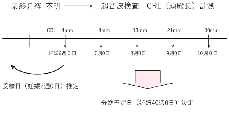 分娩予定日推定