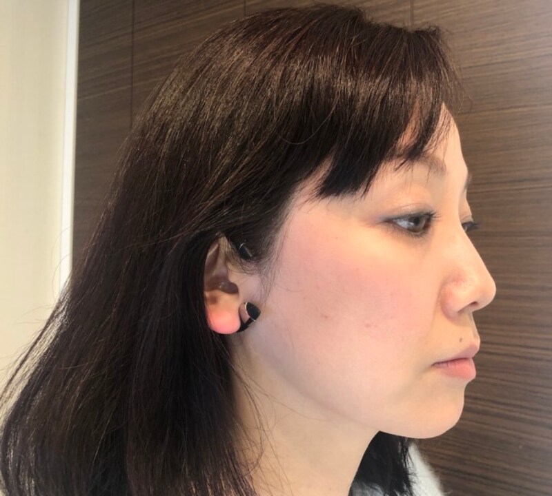 イヤーアップ,avex beauty method,耳にかける美顔器,美顔器,イヤーアップ装着