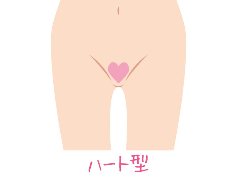 遊び心のあるアンダーヘアです。ハートの上部は少しずつ処理しましょう