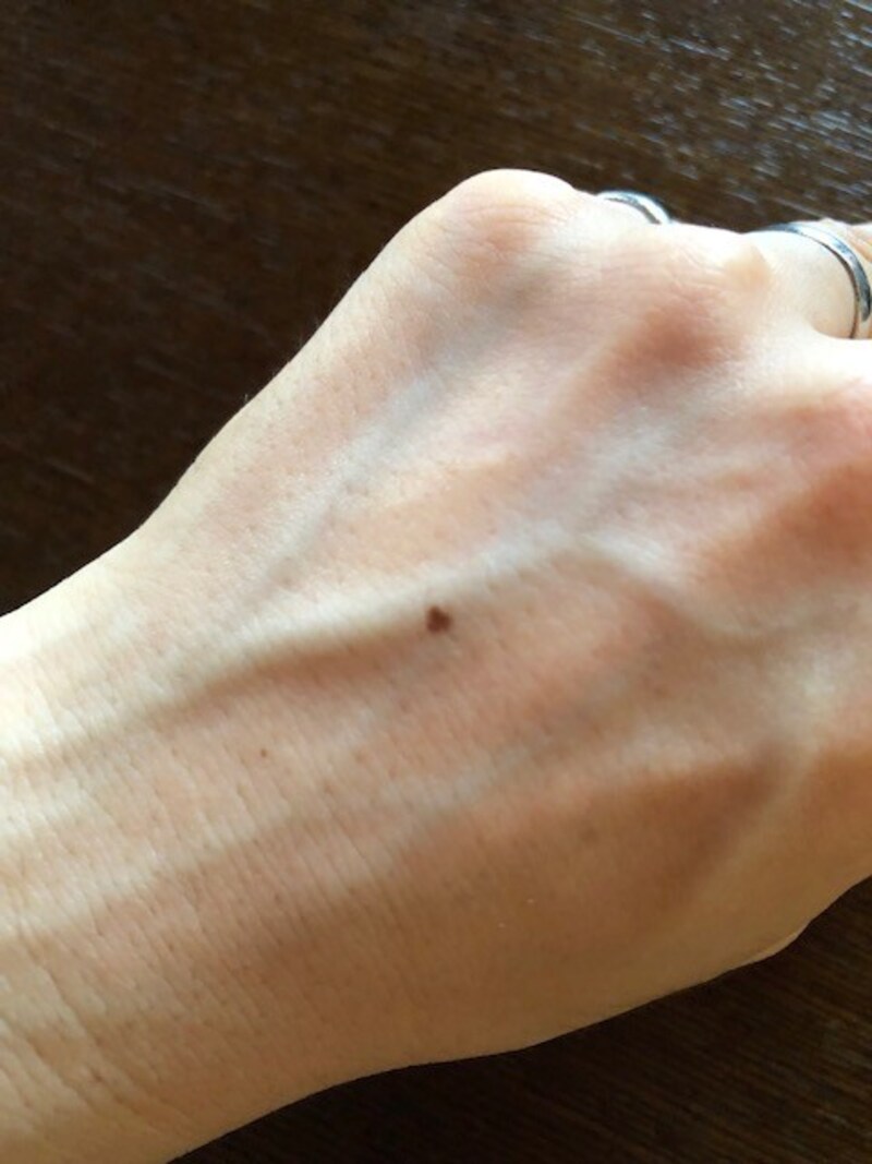 手の甲にあるホクロ。