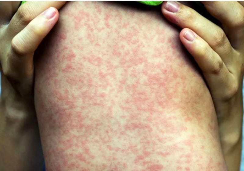 医師の診察を受ける時期