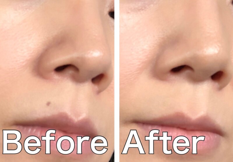 資生堂,スポッツカバーファウンデイション,H100ベースカラー部分用,コンシーラー