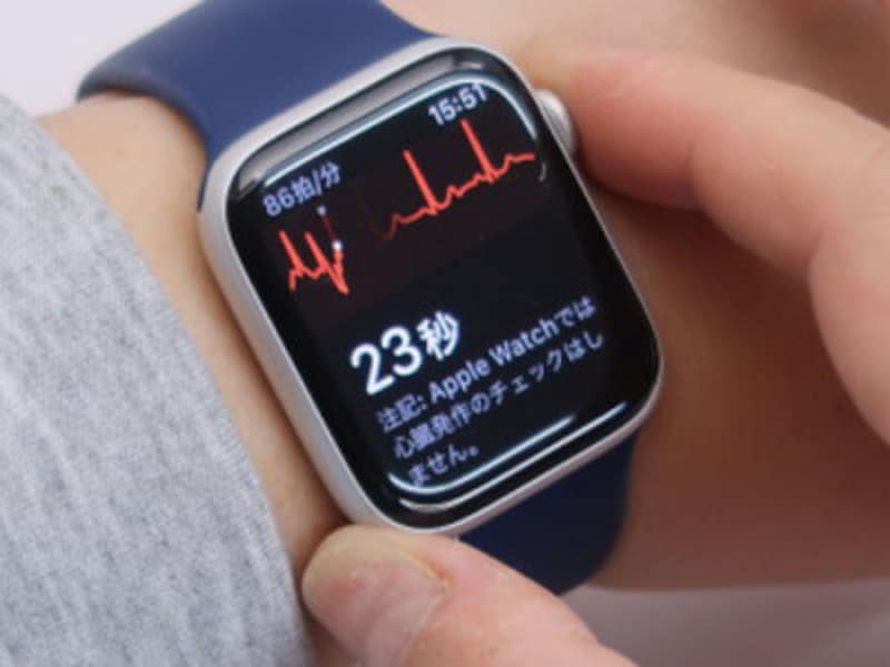 Apple Watchを使って心電図を記録できる