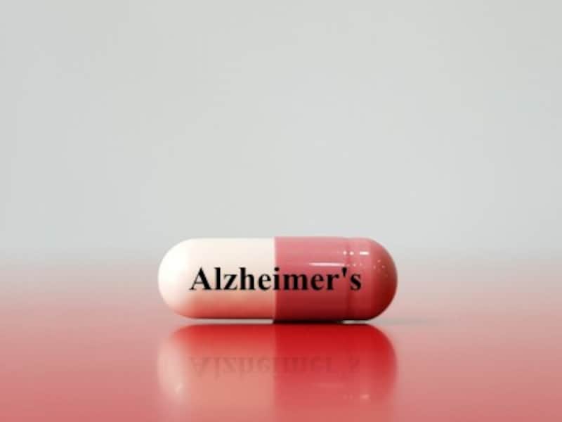 アルツハイマー病の治療薬開発イメージ