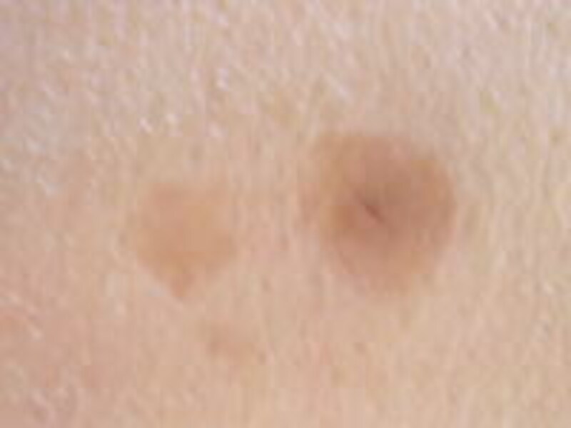 あなたのシミ 毛穴がメイクで消せない理由があった シミ 毛穴対策メイク必勝法 ベースメイク All About