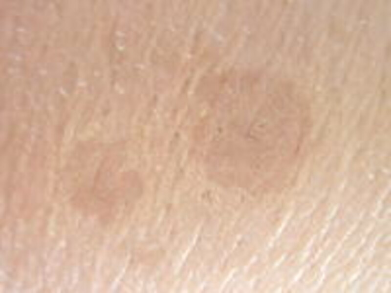 あなたのシミ 毛穴がメイクで消せない理由があった シミ 毛穴対策メイク必勝法 ベースメイク All About