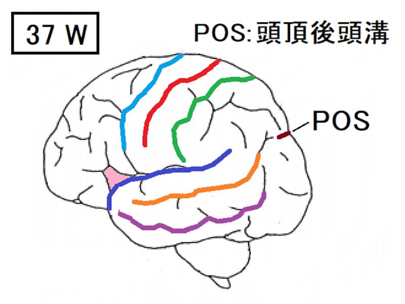 胎児,大脳皮質,頭頂後頭溝,