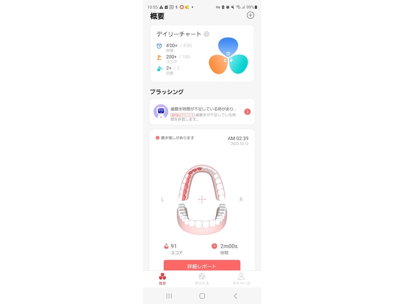 「Oclean Care+」で歯磨きデータの確認