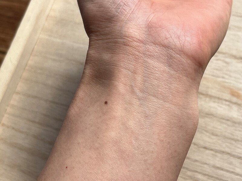 キャンドゥの「リキッドコンシーラー」をほくろにつけてみる