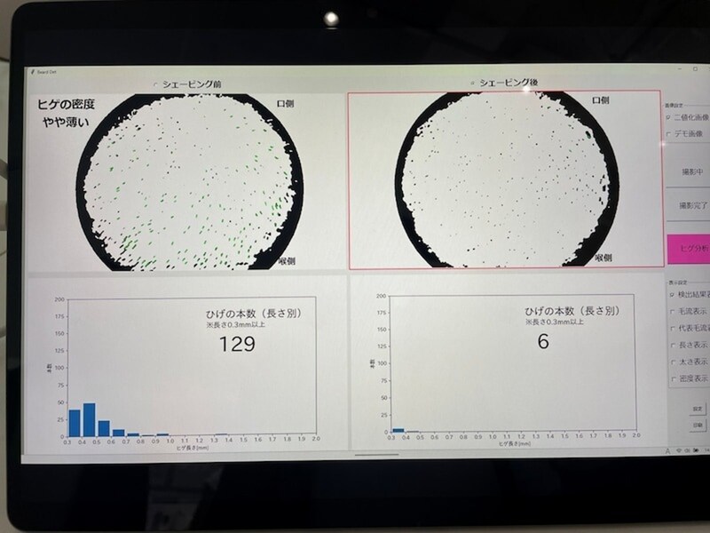 129本あったヒゲは6本まで減りました