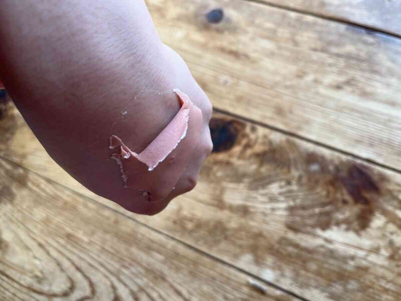 20分ほど経過すると、剥がせるようになる