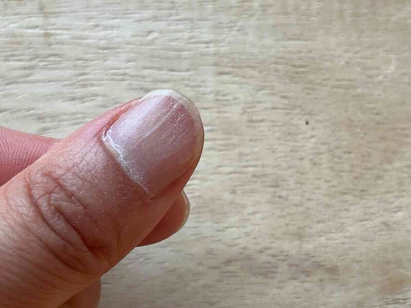 爪の表面が削れているので、白い粉が付着している