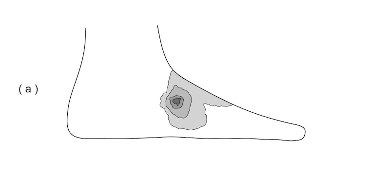 無回転シュートを蹴る足の部位※画像：特許情報プラットフォーム