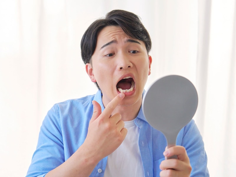 歯茎の腫れを心配する人