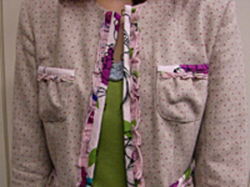 ウンガロフィーバー