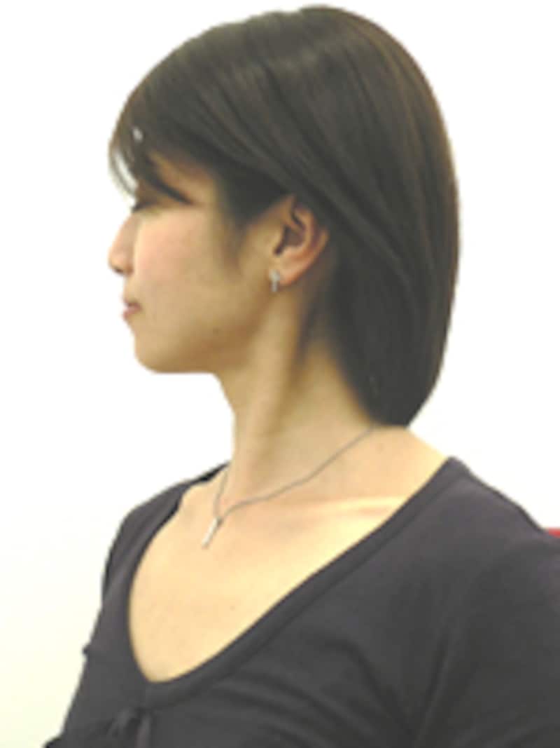 顔の歪み