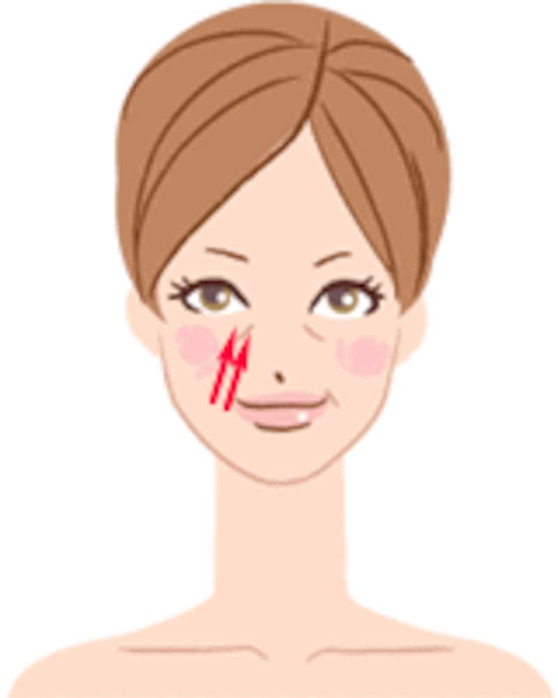 笑いじわ解消マッサージ