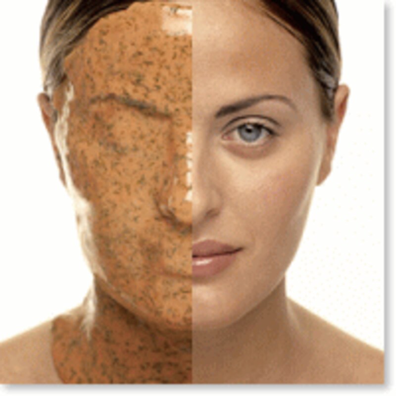 カスマラトリートメント