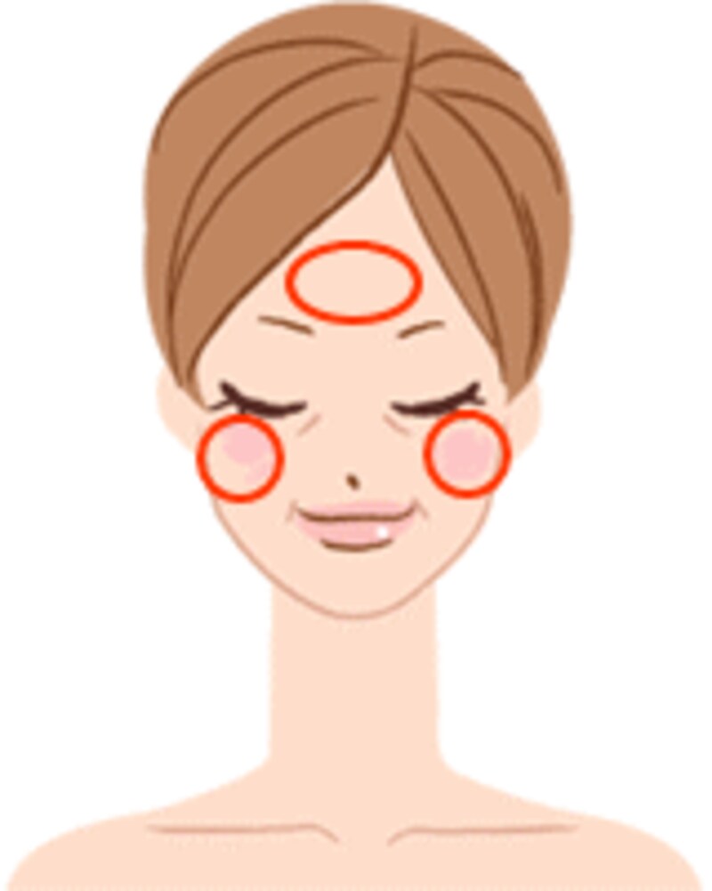 肝斑は、額やほほ骨を縁取るように左右対称に広がるように生じるのが特徴です。