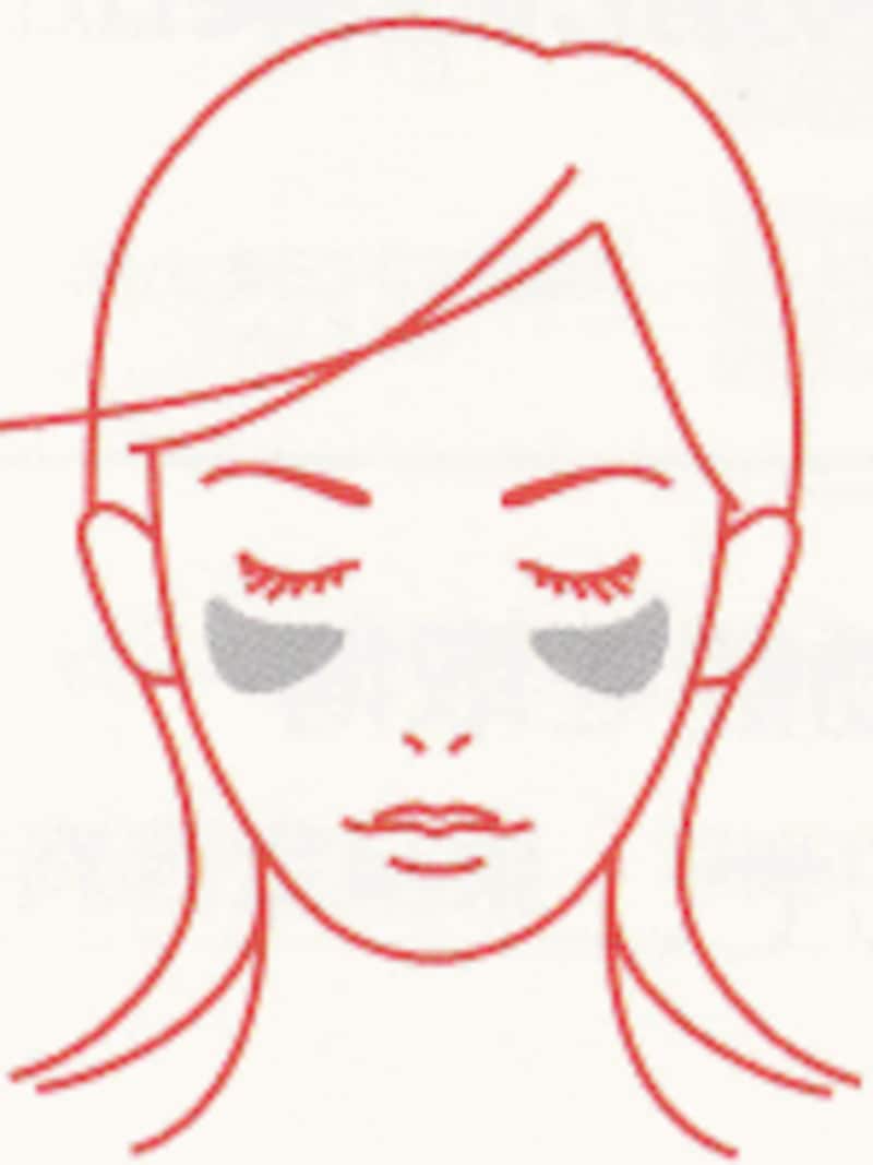 肝斑は、額やほほ骨を縁取るように左右対称に広がるように生じるのが特徴です。
