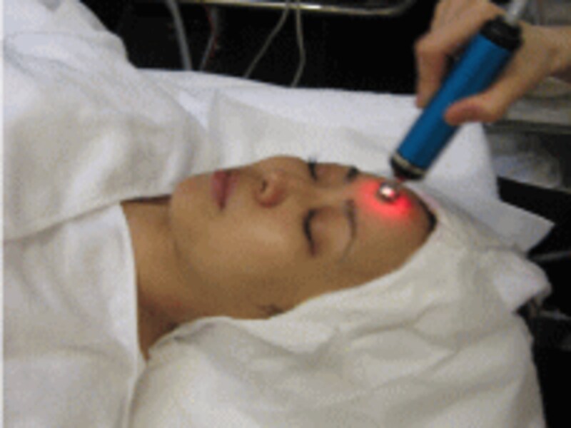 エレクトロポレーション