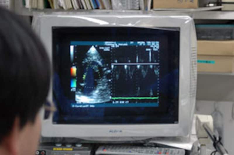 心臓のエコー検査