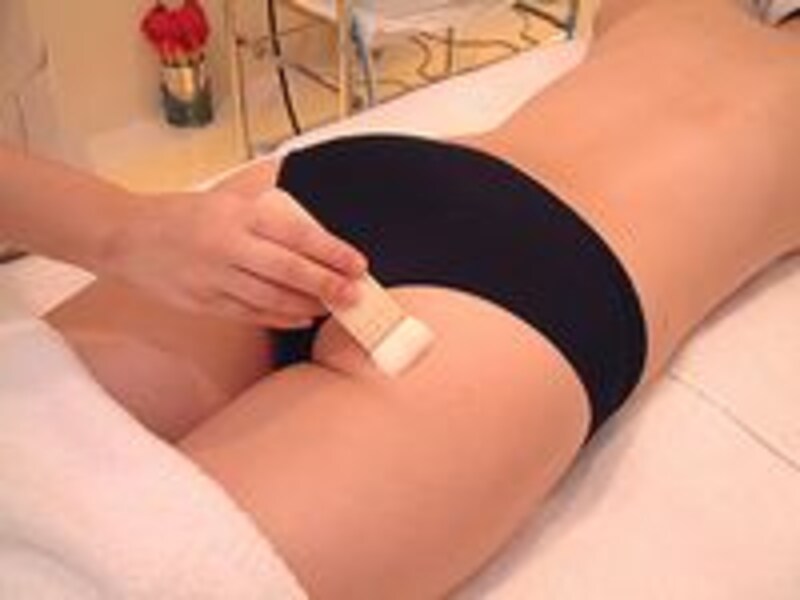 ケミカルピーリング