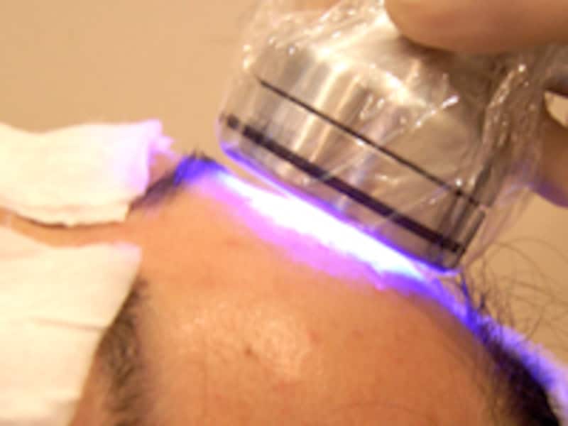 ライトセラピー