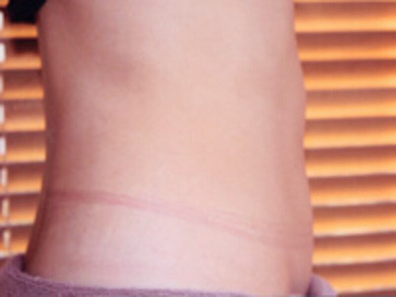 横向きアフター