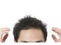 自己診断薄毛チェック術……気になる人必見！
