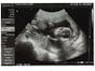 妊娠16週目：赤ちゃんの性別が分かる人も！胎児の大きさ・エコー写真