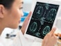 若年性認知症が30年で2倍に？ 40歳から急増する早期発症型アルツハイマー病のリスク要因と予防法