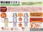 2025年4月定期接種化！ 帯状疱疹ワクチンの必須知識：種類・費用・後遺症リスクを徹底解説