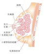 乳腺炎の治し方には、マッサージや食事による方法と、上の画像のように本格的な症状が出た場合は、医師による治療が必要な場合があります。