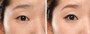 before ⇒ after