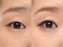 ビフォーアフター
