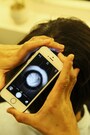 スマホにレンズを装着して頭皮を診る