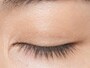 まぶたを閉じた状態のビフォア。
