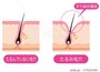 開き毛穴が悪化して起こるたるみ毛穴