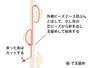 玉留め