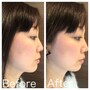 イヤーアップ,avex beauty method,耳にかける美顔器,美顔器,イヤーアップ効果