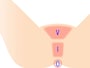 VIOとはアンダーヘアのどの部分？