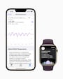 Apple Watchのヘルスケア機能イメージ