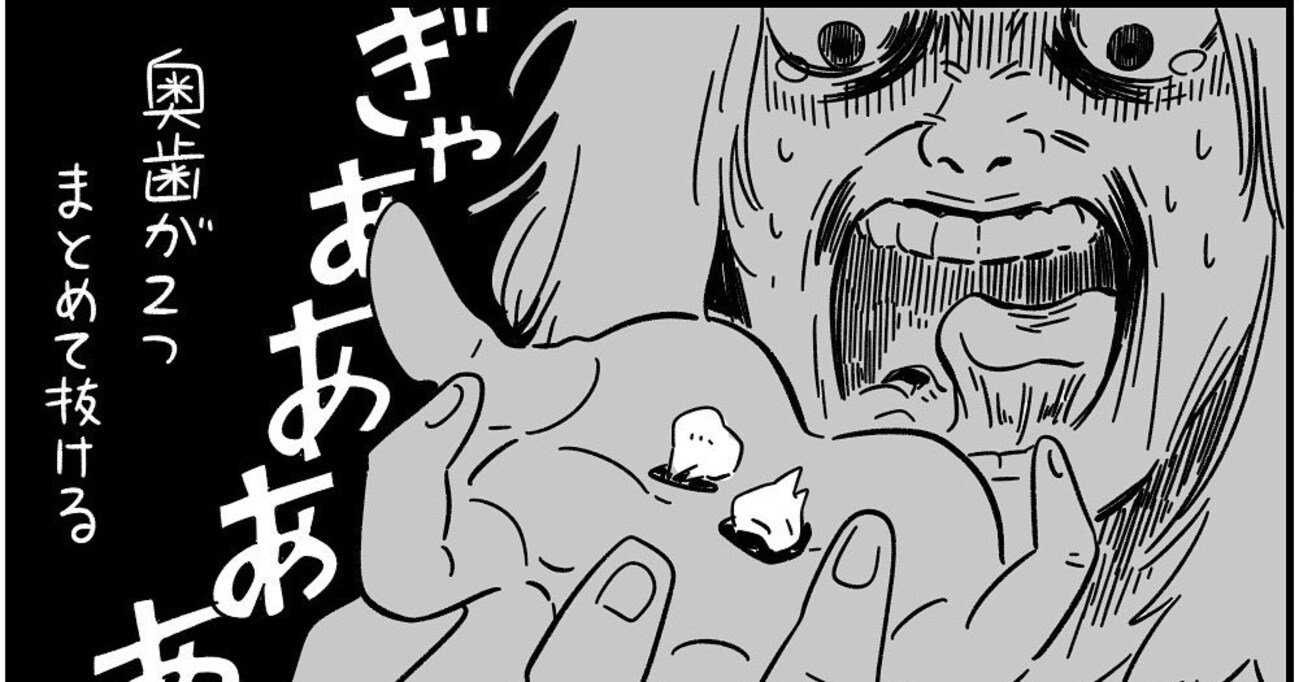奥歯が2本まとめて抜ける夢を見た翌朝…偶然とは思えない出来事にゾッとする