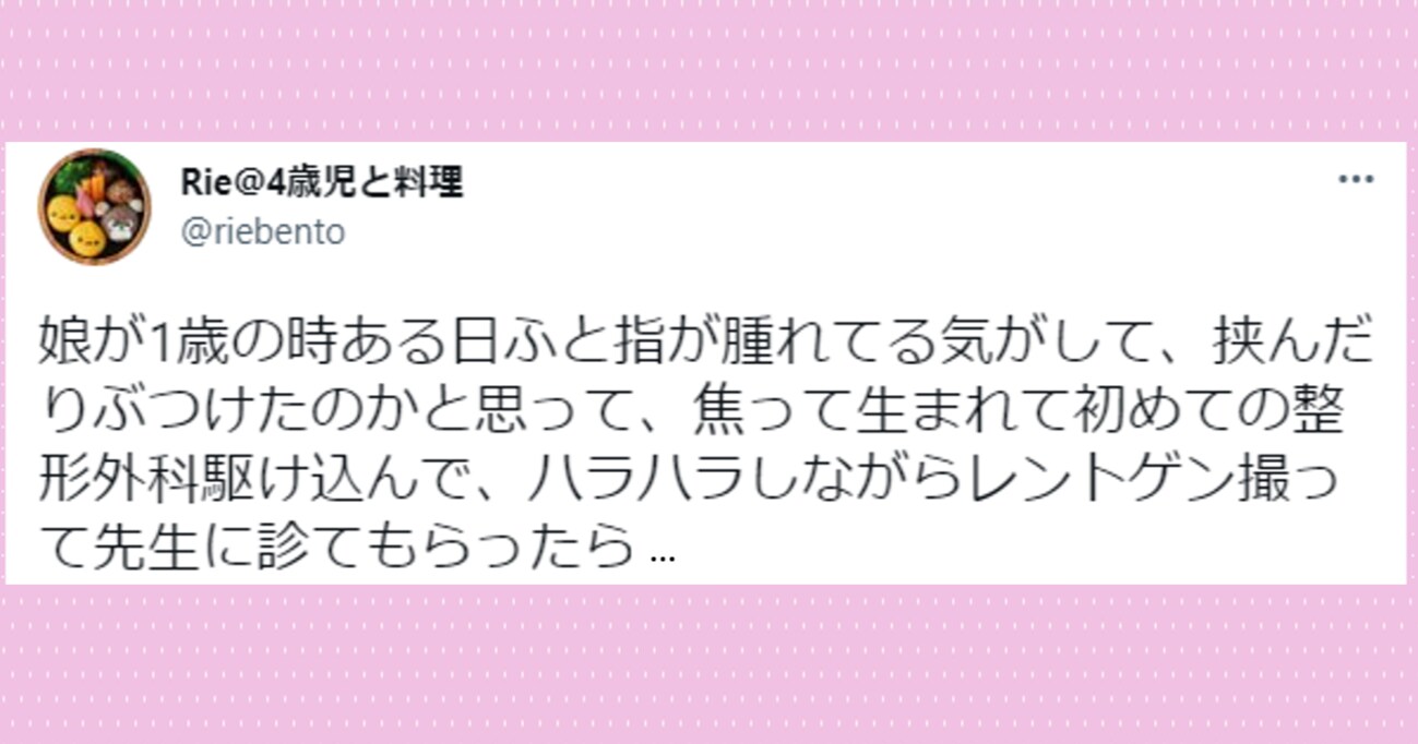 まさかの診断結果に！？1歳娘の指が腫れていると思い、病院でレントゲンを撮ってもらうと…