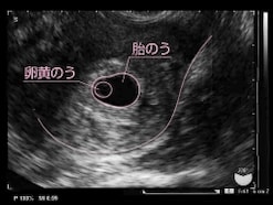 妊娠5週目 胎嚢の大きさ・エコー写真、つわり症状や流産のこと