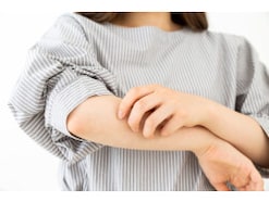 Q. 「アトピーだと、がんにならない」って本当ですか？