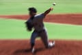球春到来で考察、野球選手に薄毛が多い理由
