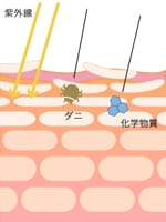画像の代替テキスト