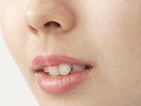 老化が加速する!? 口半開きはキケン！